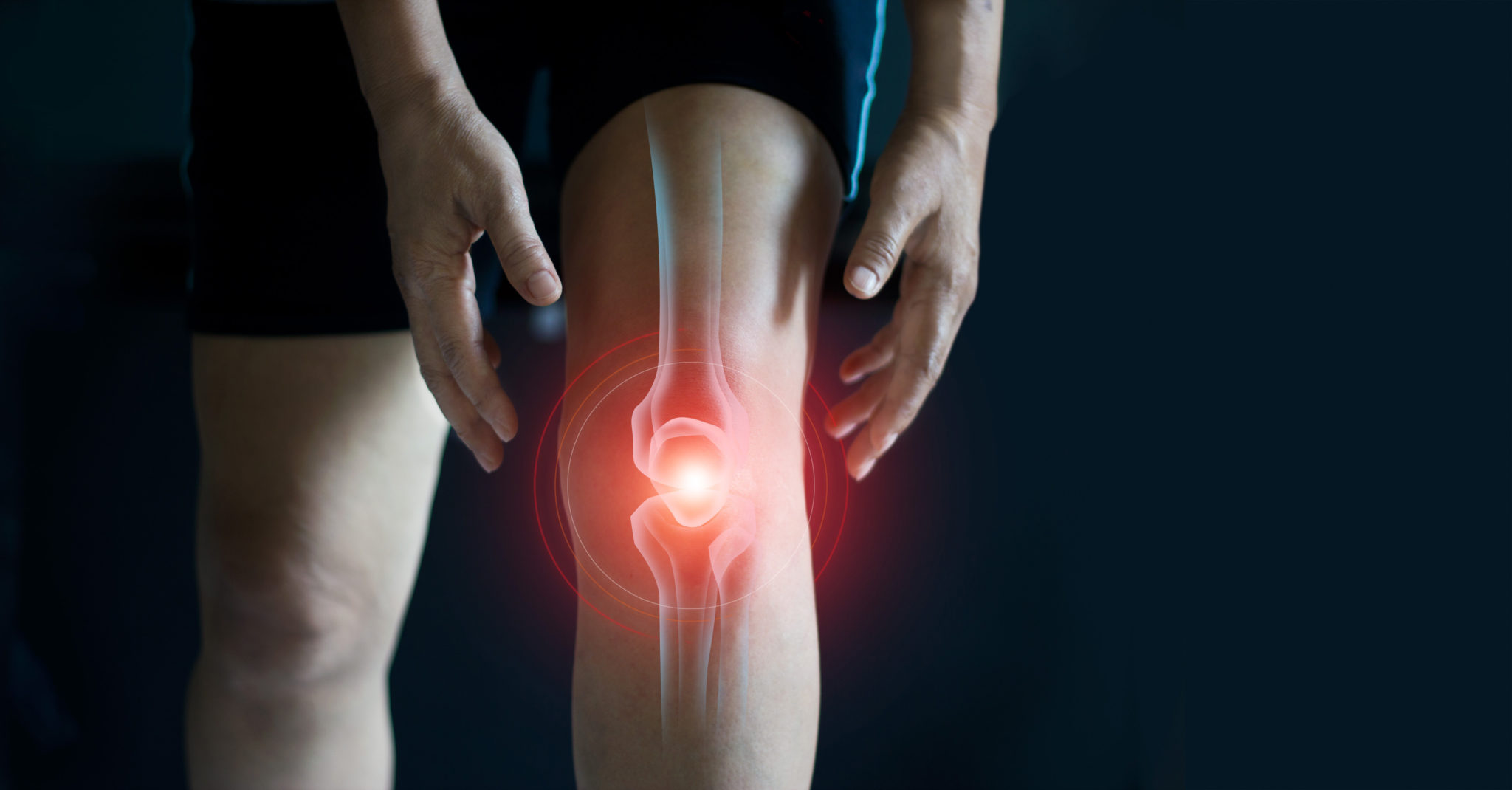 4 простых способа избавиться от боли в коленях